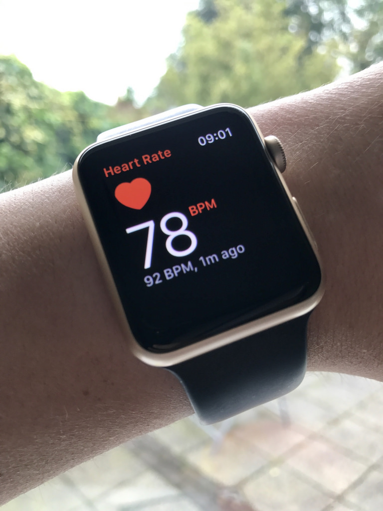 The Lifesaving Apple Watch and Its Significance for Medical Students